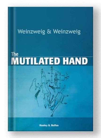 The Mutilated Hand by Norman Weinzweig and Jeffrey Weinzweig