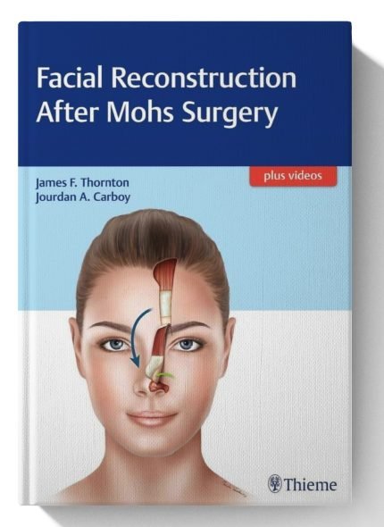 Facial Reconstruction After Mohs Surgery