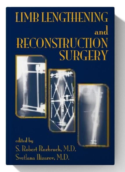 Limb Lengthening and Reconstruction Surgery