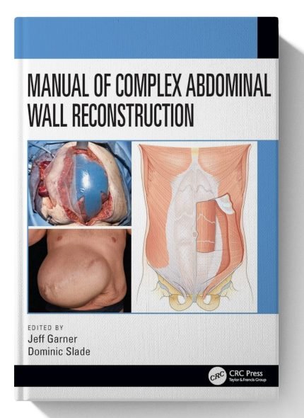 Manual of Complex Abdominal Wall Reconstruction