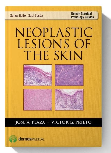 Neoplastic Lesions of the Skin (Demos Surgical Pathology Guides)