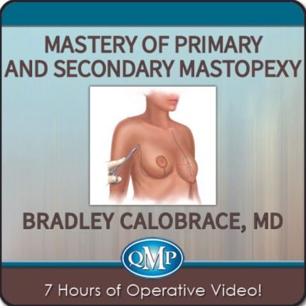Mastery of Primary and Secondary Mastopexy