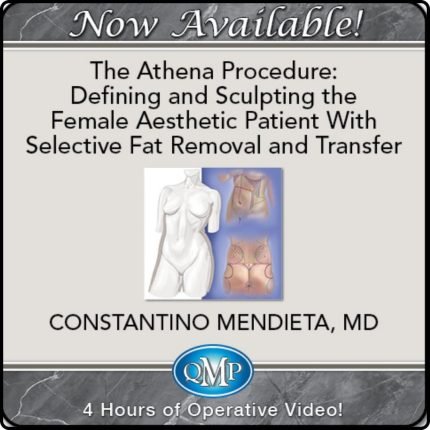 The Athena Procedure: Defining and Sculpting the Female Aesthetic Patient With Selective Fat Removal and Transfer