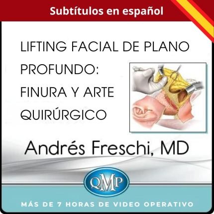 LIFTING FACIAL DE PLANO PROFUNDO: FINURA Y ARTE QUIRÚRGICO