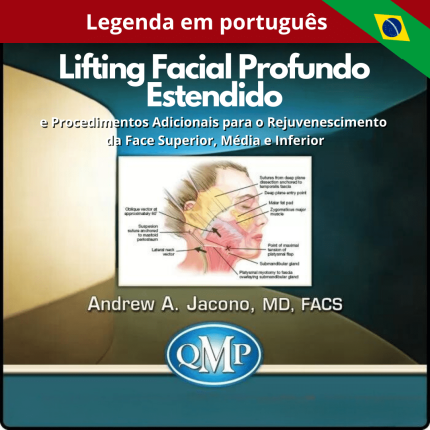 Lifting Facial Estendido em Plano Profundo e Procedimentos Adjuvantes para Rejuvenescimento da Face Superior, Média e Inferior.