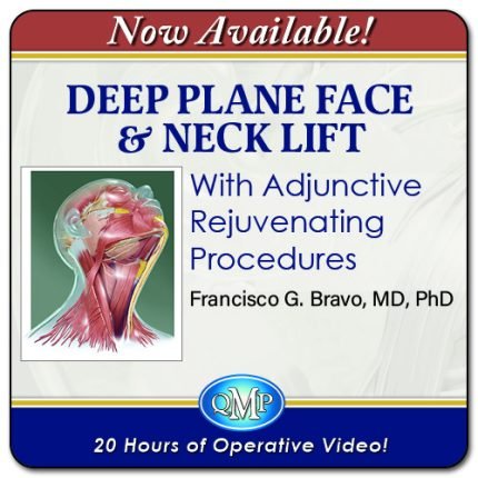 Deep Plane Face & Neck Lift With Adjunctive Rejuvenating Procedures