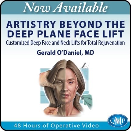 Artistry Beyond the Deep Plane Face Lift: Customized Deep Face and Neck Lifts for Total Rejuvenation