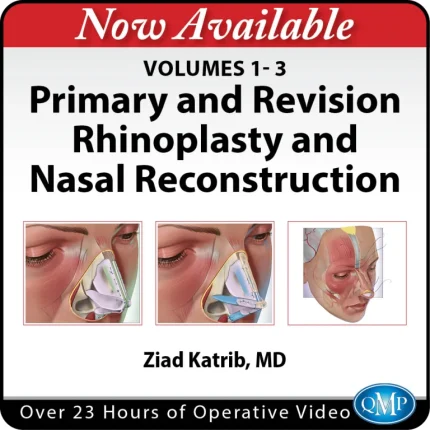 Primary and Revision Rhinoplasty and Nasal Reconstruction, Volumes 1-3 2026